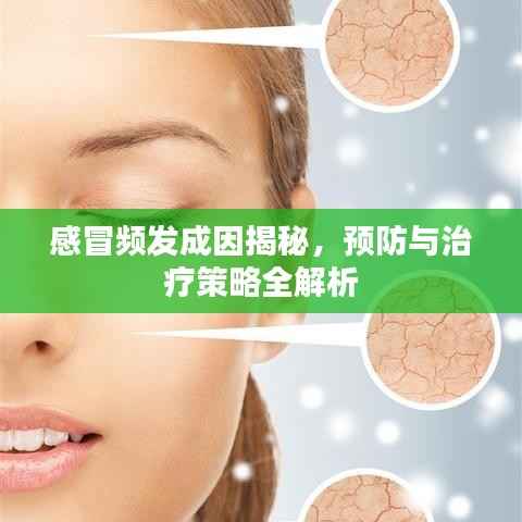 感冒频发成因揭秘,预防与治疗策略全解析